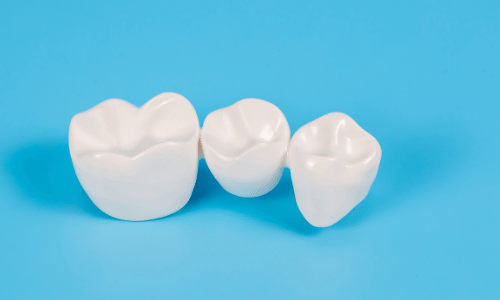 dental crowns and bridges model